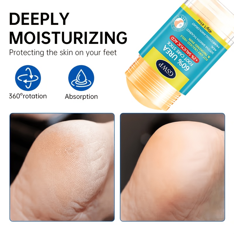 GSWP 60% Urea Foot Care Stick, - Urea Foot Cream review and price
