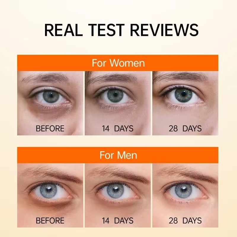 Anti Dark Circle Eye Serum Oil - Caffeine Eye Serum review and price