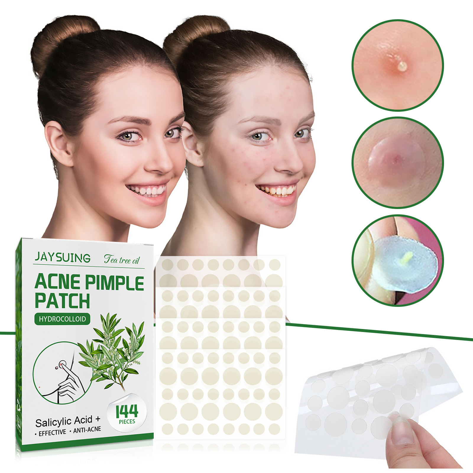 Hydrocolloid Acne Patches - Ab - Skincare Moisturizer review and price