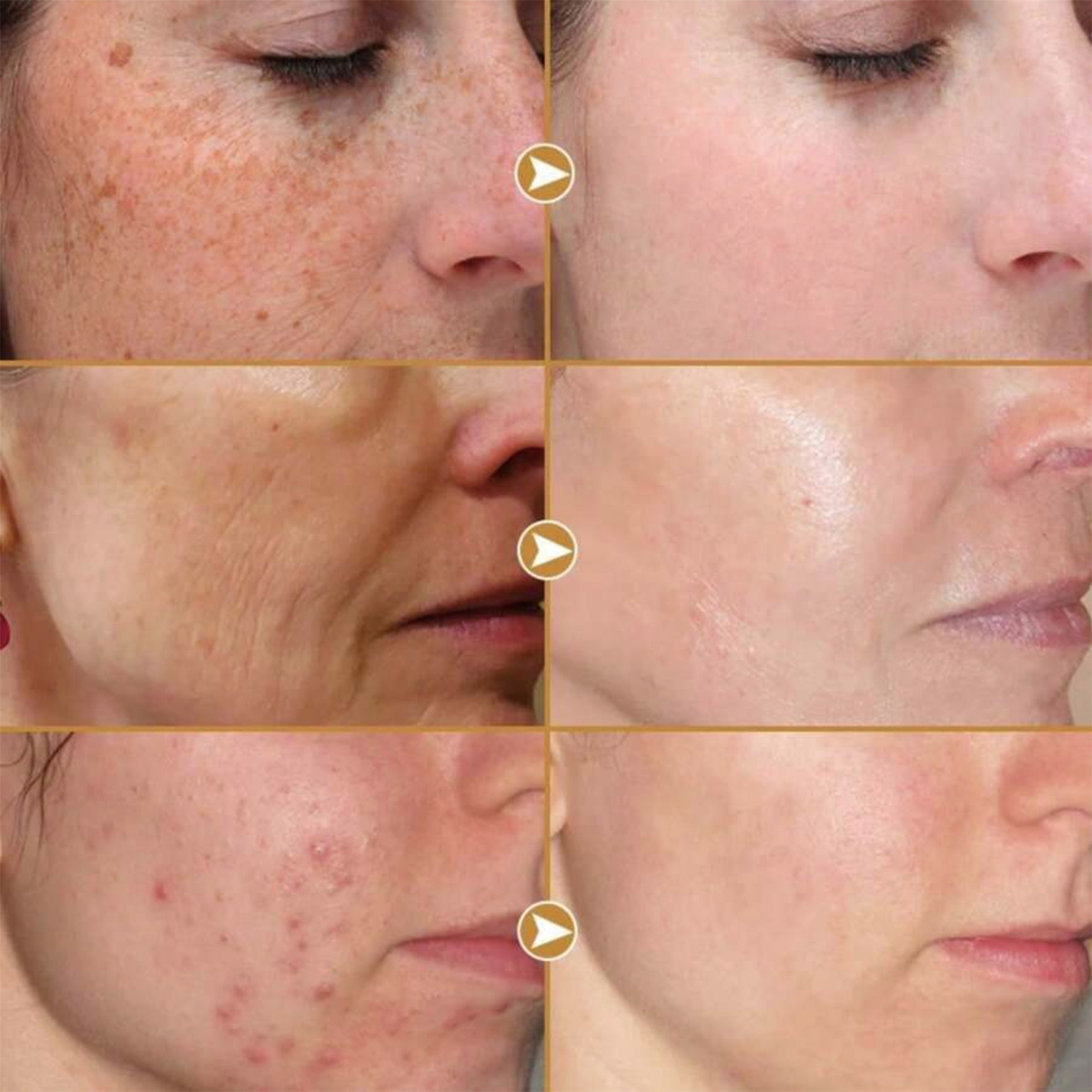 TRSTAY Peptide Compound Essenc - Peptide Neck Cream review and price