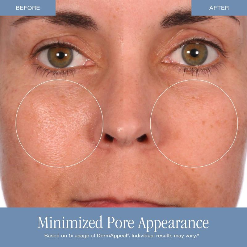 Cosmetics DermAppeal Microderm - Skincare Moisturizer review and price
